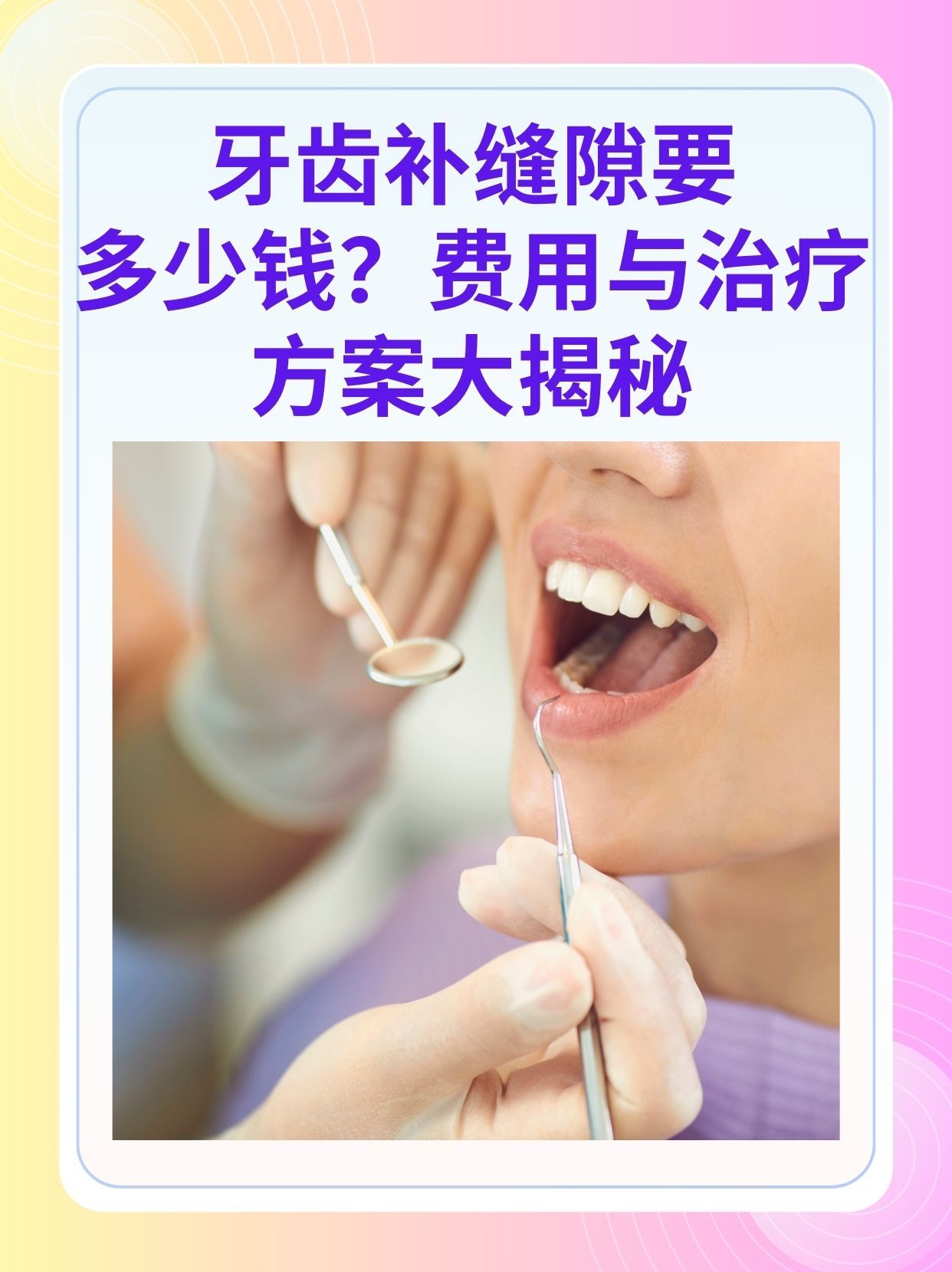 辽宁补牙医保可以报销吗(补牙医保可以报销吗 哪些可以报销呢)